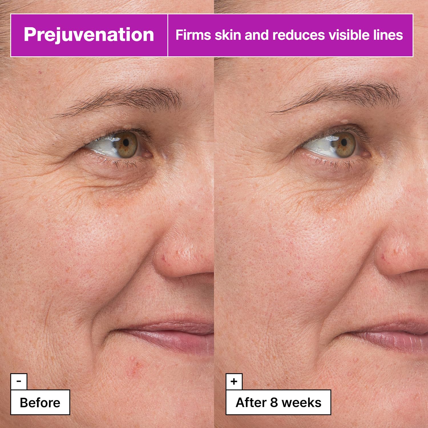 Dr.Jart+ Prejuvenation Firming Bakuchiol Serum with Collagen Peptides | Korean Anti Aging Serum | Sensitive Skin Friendly | Korean Skin Care, 1.69 Fl Oz